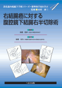 右結腸癌に対する腹腔鏡下結腸右半切除術