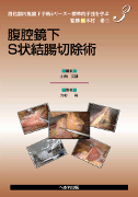 腹腔鏡下S状結腸切除術