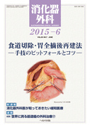 消化器外科 2015年6月号