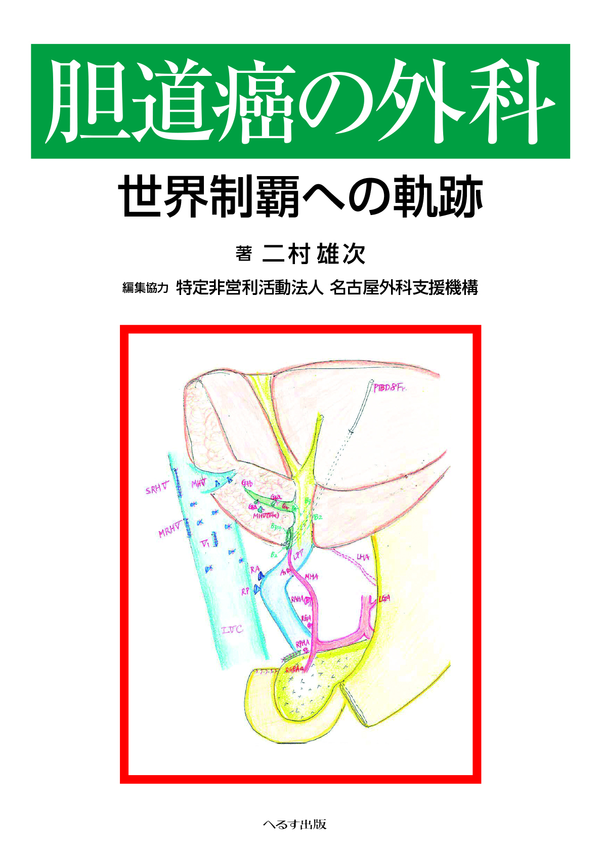 胆道癌の外科