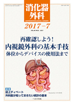 消化器外科 2017年7月号